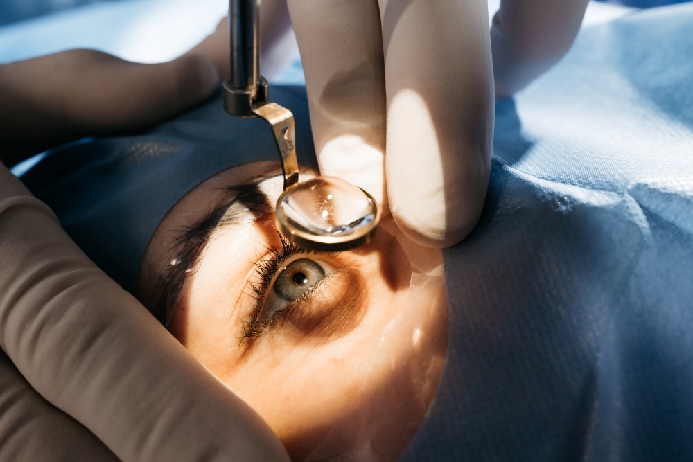 What Is Orbital Decompression Surgery?